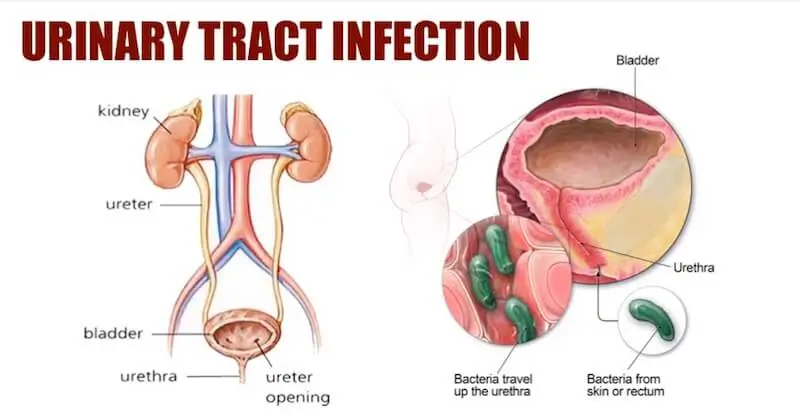 Uti